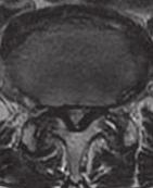 7 Lumbar MRI T2WI A sagittal, B