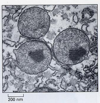 ミクロボディ microbody 直径 0.