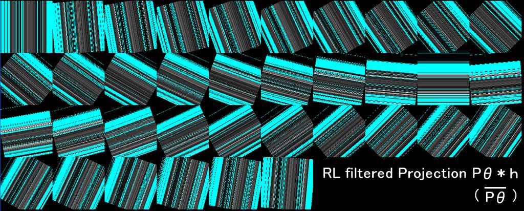 180 枚の 2 次元透視画像 Pθ に実空間 Ramp (RL)