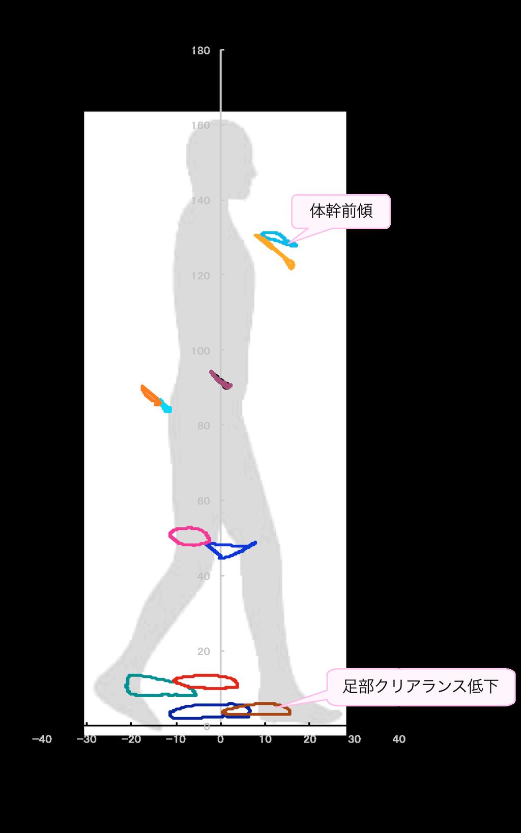 麻痺側の骨盤挙上 図 7 は 左右の股関 節のリサージュ図形の位置関係で判断でき た 内側ホイップ 図 9 は 麻痺側 左側