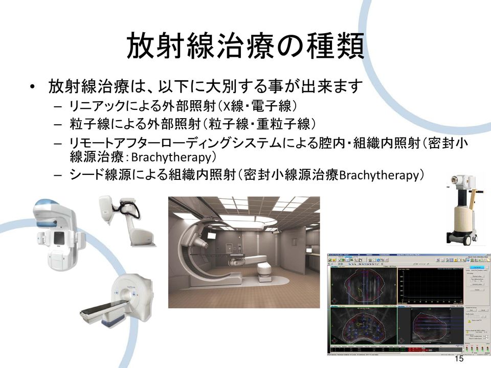 リモートアフターローディングシステムによる 腔 内 組 織 内 照 射 ( 密 封 小 線 源 治 療