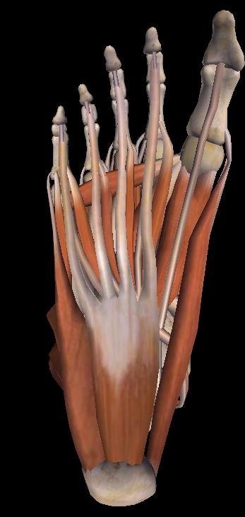 足底筋膜 ( 腱膜 ) 炎ルーチン 足底筋膜炎 踵骨の骨棘生成 足底腱膜の炎症 足底部の蜂窩織の炎症 発生機序