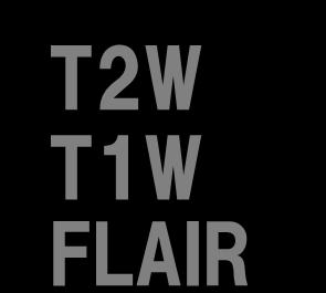 T2W T1W FLAIR 水素原子の緩和の差を画像化