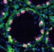 We also investigate epigenetic regulation involved in the gem cell development.