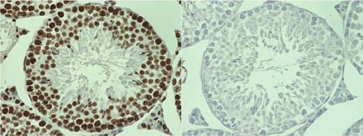 Tissue: ischemic mouse liver* Mouse IgG2b Immunocytochemistry Nucleotide length Cells: HeLa Green: Anti-1-methyladenosine (m 1 A)