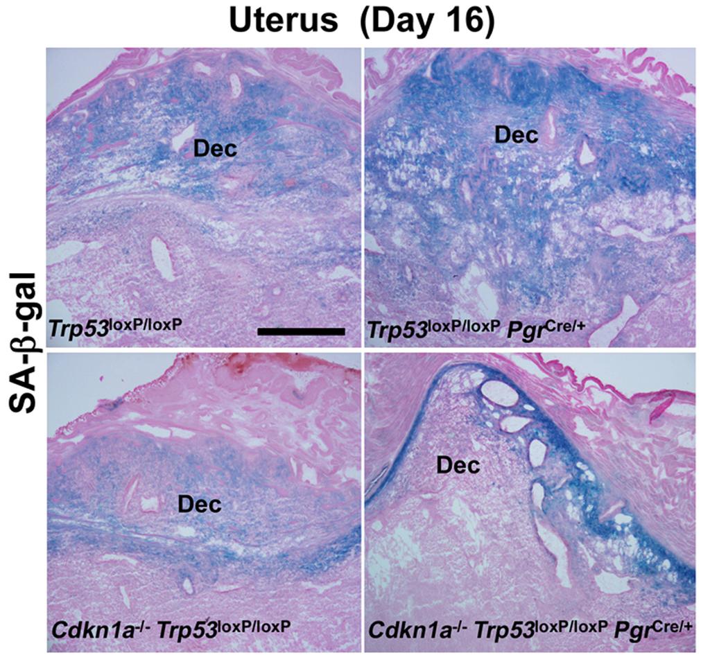 ラパマイシン処理後の分娩前 妊娠 16 日目 の子宮を用いて 脱落膜細胞を細胞老化マーカーである SA-β-gal 染色に 加えて p21 COX2 PGFS の発現定量を行ったところ 細胞老化に加えて p21 COX2 および PGFS 発現が抑制されて いることがわかった 4) さらに子宮老化が早産の誘因である可能性を示すために 子宮特異的 p53 欠損マウスを用いた早産モデルを応用し 細胞