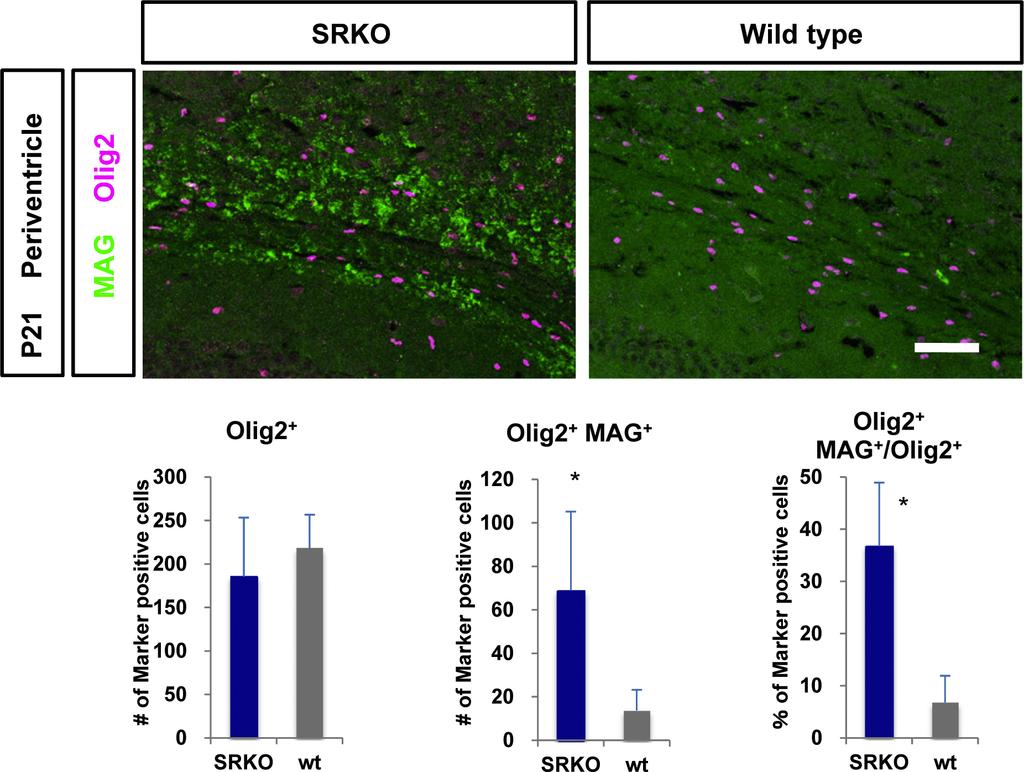 図 5 SRKO マウスにおけるオリゴデンドロサイトの成熟促進. 生後 21 日 P21 脳切片を抗 Olig2 抗体, 抗 MAG 抗体にて染色した. 海馬周辺の脳室周囲細胞の Olig2 陽性細胞 において MAG 発現細胞の増加と Olig2 陽性細胞中の MAG 陽性成熟オリゴデンドロサイトの増加を認める. *P<0.05 vs wt, scale bar 100μm.