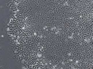 赤血球前駆細胞および CD34 + 細胞からのリプログラミングに最適 繊維芽細胞からも効率よくリプログラミングが可能 従来培地より高いリプログラミング効率 ips 細胞コロニーの形態が明確で