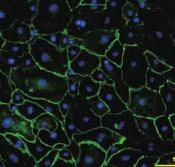 ヒト ES/iPS 細胞の分化 ヒト ES/iPS 細胞からの分化 ( 外 中 内胚葉 ) STEMdiff TM APEL2 TM Medium STEMdiff APEL2 Medium は ヒト多能性幹細の胞分化をサポートする多用途培地です 心筋細胞 造血細胞 内胚葉細胞への誘導系で利用例があります 特に 心筋細胞の分化では AggreWell 400 を使用し EB