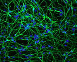 ニューロンとアストロサイトの 共培養 に最適 ips 細胞は integration free の方法で調製 ゲノム配列 マイクロアレイ発現解析等で分析済み 前駆細胞の状態でお届け 高い増殖能 細胞の利用に必要なライセンス取得済み 規格例 NEURONS の場合 成熟ニューロンの例 1 10 6 viable neurons >70% cell recovery 90% Tuji-1