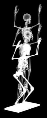 外的膝関節モーメ ントを逆動力学解析により算出し, 各セグメントの慣性モーメントは de Leva 45) の報告に 基づいた. また, 外的膝関節モーメントは各被験者の体重と身長により除し, 標準化した (Nm/(kg*m)). DVJ と DL の二つの着地動作では, 台からの着地における IC 時から膝関節最大屈曲時 までの区間を解析の対象とした.