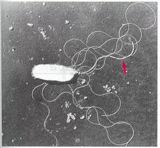 プロテウス菌 腸炎ビブリオ