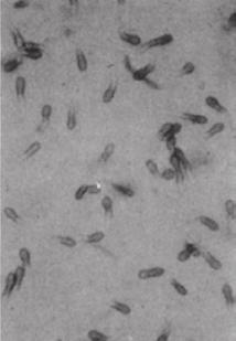 作用機作 作用特性 抗菌スペクトラム 作用機作 ジチアノンは幅広い抗菌スペクトラムを持ち 多くの糸状菌に有効です また 一部細菌性病害 ( バクテリア ) にも有効です 作物名 病害名 英名 学名 活性 炭疽病 Anthracnose Colletotrichum gloeosporioides ++++ 黒腐病 Black rot Alternaria citri ++++ かんきつ