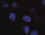 6 Cells: HeLa 赤色 :Anti-2,2,7-trimethylguanosine (m 3 G/TMG) mab (RN011M) 青色 :DAPI Code No.
