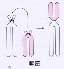 イ ) ロバートソン転座 通常 13 14 15 21 22 の 2 つの異なる染色体 ( 非相同染色体 ) で それぞれの短腕部が切断されて