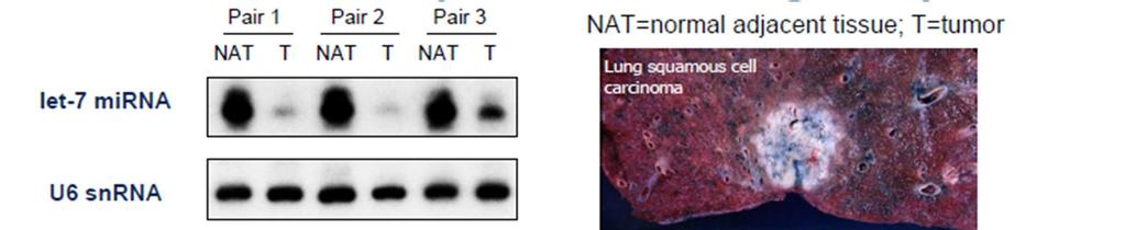 肺がん組織での Let-7とRAS の発現レベルの相関性の確認