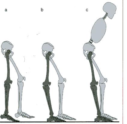IC でのフォアフットコンタクト後の LR では, 足関節に可動性がある場合踵が荷重によってすばやく床に落ちる ( 下腿はほぼ直立したまま ). 可動性がない場合, 踵が床から浮いたままの状態 ( ヒールオフ ) か, 踵が床方向へ押されて膝関節が急激に過伸展される ( 図 13).