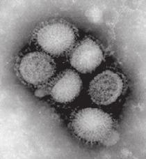 ヒトでは N1および N2が重要である 図 7 は 名古屋市衛生研究所において撮影された季節性インフルエンザウイルスの電子顕微鏡写真 ( 4 万倍 ) である 患者から分離直後はやや細長く連鎖状のものが多い 継代培養を重ねると球形に分離すると言われている 3.