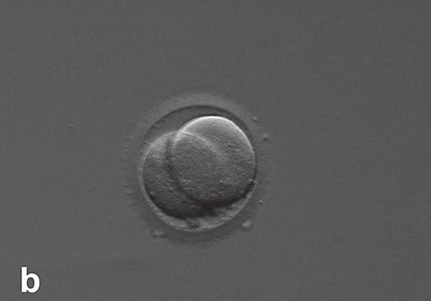 不動精子だけが存在 ５ その他 抗透明帯抗体による受精障害など る 臨 床 的 妊 娠 の 判 定 は day21に 経 腟 超 音 波 法による胎嚢 gestational sac