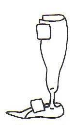足関節角度と制動モーメントの関係が線形に近い (d) ヘミスパイラル型短下肢装具底屈方向には比較的硬く, 背屈方向には柔らかい.