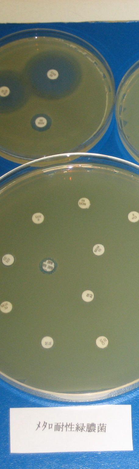 一般的な緑膿菌