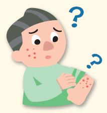 エルプラット R の予想される主な副作用とその対処法ー 6 アレルギー反応 アレルギー反応 ( 過敏症 ) エルプラット R を点滴注射している間 あるいは注射後に 過敏症によるアレルギー反応があらわれることがあります 主なアレルギー反応としては 息苦しい からだがかゆい 皮膚に赤いぶつぶつが出る ( 皮疹 ) 皮膚が赤くなる 全身が腫れる などがあります