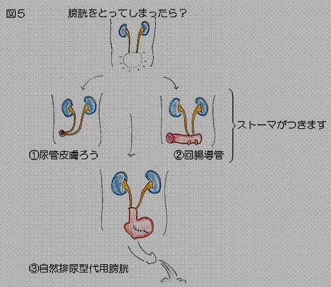 精嚢 前立腺 ( 尿道 )