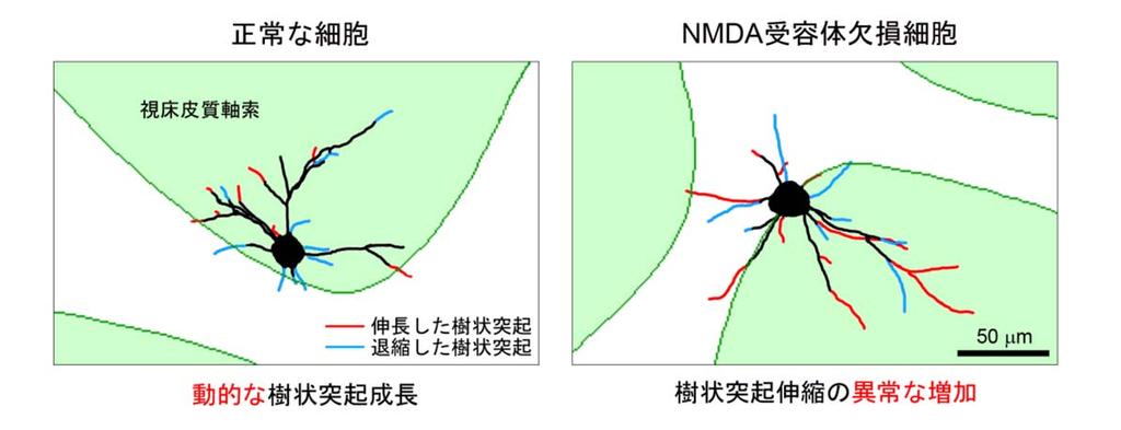 図 3 樹状突起の枝の 18 時間の変化 ( 伸縮 ) を定量的に解析しました 正常な神経細胞では 樹状突起の個々の枝には 18 時間で伸びたものと縮んだものがありましたが ( 左上 ) 全体として視床 皮質軸索の固まりのあるバレル内側方向 ( 上図の緑色部分 ) に広がっていくことがわかりました ( 左下 : 正常な細胞 ) NMDA 受容体のはたらきを抑えた細胞では