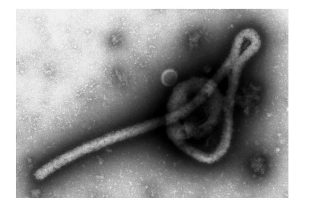 蛋白質を発現する人工細胞では効率良く増殖することができます ９ 添付資料 図１ エボラウイルスの電子顕微鏡写真 左図 細胞に感染させた