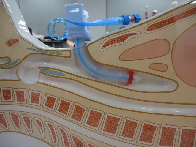 気管カニューレの装着と食道の模型図 気管 ( 肺に続く ) 食道 (
