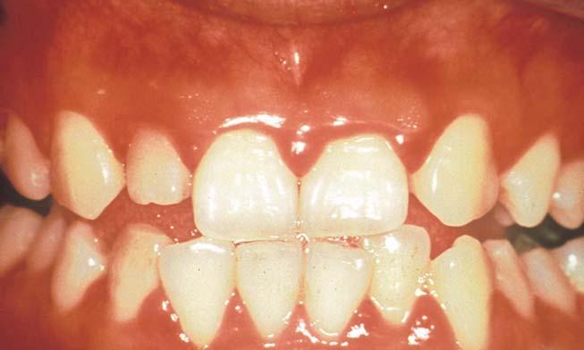 D 363 D-36(3) 歯周病予防のためのセルフチェックリスト 歯周病は 自分で気付かないうちに進行し 自覚症状が出たときにはかなり重症になってしまっていることが多い病気です セルフチェクで早めの対応を!