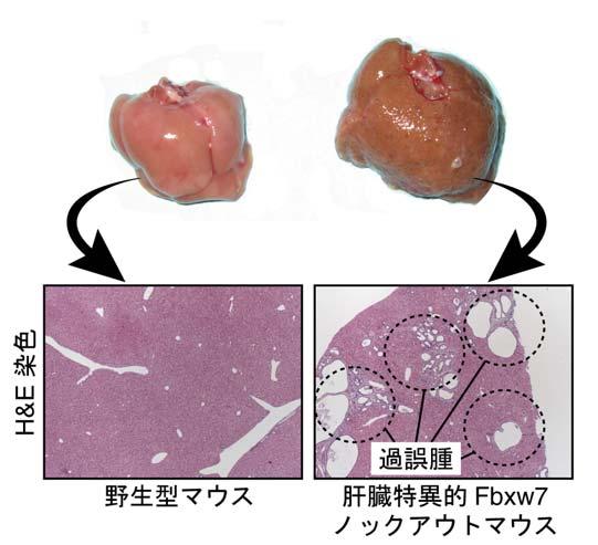 < 参考図 > 図 1 Fbxw7 欠損 3 週間後の肝臓マウスの肝臓からFbxw7がなくなると わずか3 週間で激しい脂肪肝が引き起こされます