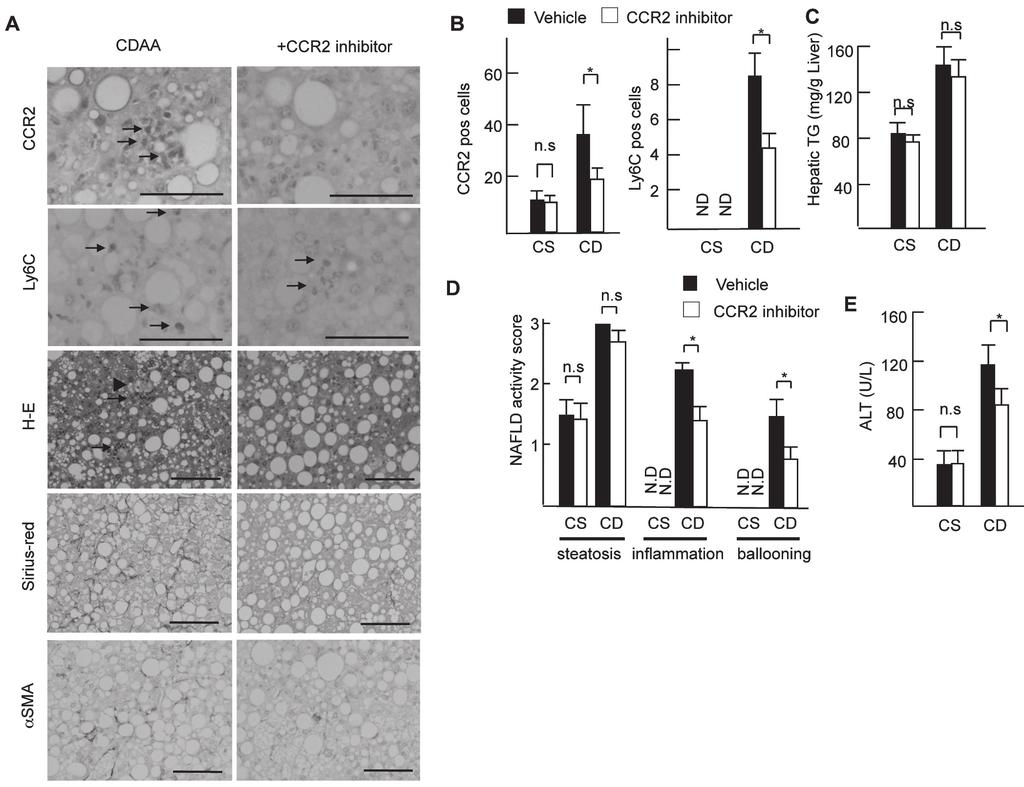 6 CCR2 WT マウスに CDAA 食を 18 週負荷後に CCR2 阻害剤を 4 週間同時投与した所見 (A) 上段より CCR2 免疫染色 Ly6C 免疫染色 HE 染色 Sirius red 染色 α SMA 免疫染色. (B) CCR2 陽性細胞数および Ly6C 陽性細胞数. (C) 肝組織中性脂肪量. (D) NAFLD activity score.