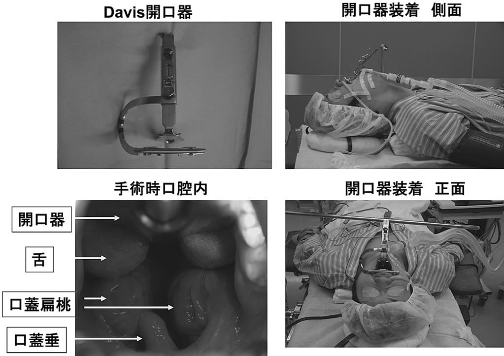 25 1 8 3 yesno n35 n35 LM LM, p. 198199. Sakagami M. Taste disturbance and its recovery after middle ear surgery. Chemical Senses 2005 ; 30Suppl 1: i220i221. Sone M, Sakagami M, Tsuji K, et al.
