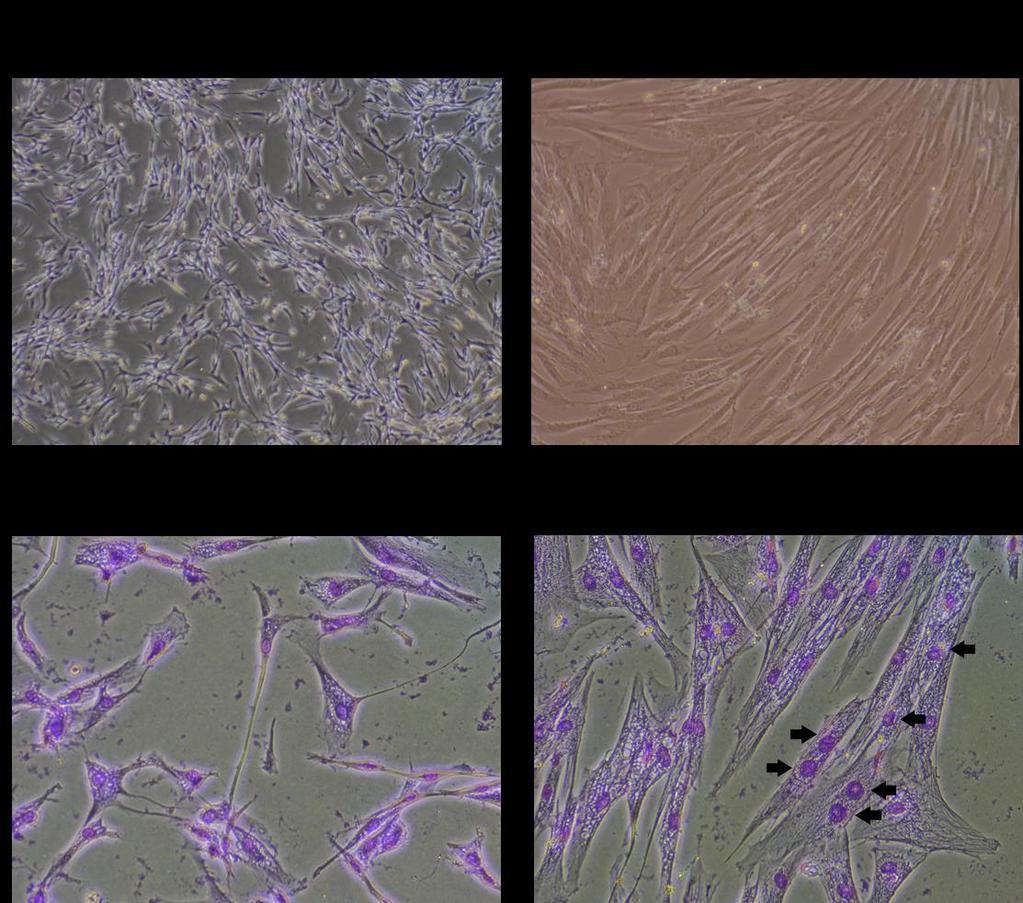 Fig. 3-1 犬培養細胞の倒立位相差顕微鏡像犬骨格筋細胞を約 4 日間培養した犬筋芽細胞 (A) 筋芽細胞を分化培地にて 96