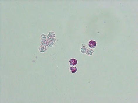 細胞質は好中球同様にアメーバ状の変化も有する The nucleus of eosinophils is often bifurcated and rounded.