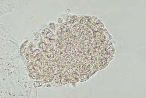 large macrophage. It shows unclear marginal structures, and its cytoplasm is stained pale reddish purple.