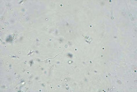 resulting in a change in the bacterial cells.