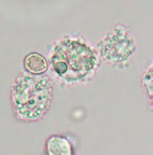 Neutrophils Eosinophils