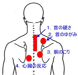 部位別肩こり治療 肩こりはどこがこるかによって意味が違います 部位別で見ていきましょう < 部位別 > 1. 首の硬さ 2. 首のゆがみ 3. 腕のこり 4. 心臓の反応 1.