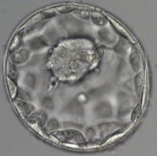 (Embryo