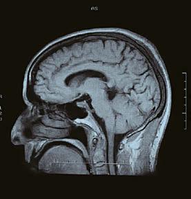MRI 検査とは M R I 検査は 磁気共鳴画像検査の略で 強い磁力を利用して