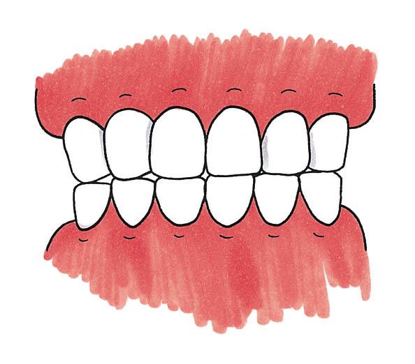 ハチマルニイマル 大人の歯は おやしらずをのぞいて28 本あります そのうち20 本以上自分の歯が残っていれば ほとんど支障を感じずに食事ができるといわれています 厚生労働省では80 歳で20 本以上の歯を残すことを目標とした 8020 運動