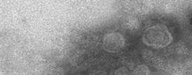 A 脂質二重膜で囲まれた 20-150 ナノメートルの小胞が観察された