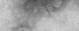 陽性エクソソーム 細胞伸長 ( ハミングバード表現型 ) 50 µm