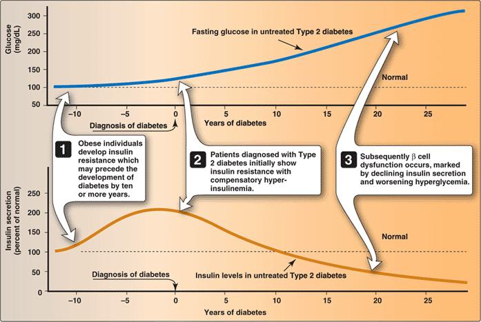 2 型糖尿病 : 血糖値とインスリン濃度の経過