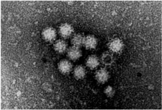 きな変化を与えた 従来ノロウイルス ( 小型球形ウイルス ) は電子顕微鏡観察でしか検出できなかったため 検出率は低く 各地の流行株の比較解析はほとんど不可能であった しかし 遺伝子構造の解明はPCR 法などの高感度遺伝子検出法の開発をもたらし 塩基配列決定法による流行株の解析を可能にした