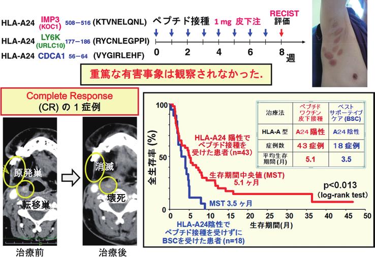 MHC 2018; 25 (1) 図2 がん免疫療法におけるがん抗原ワクチン療法の現状と将来展望 3 種類の TAA-SP 混合ワクチンを接種した進行性口腔扁平上皮癌患者における全生存率 OS の延長 公開されているアルゴリズムを用いて 多くの日本人が保有する HLA-A2 または A24 分子に結合親和性が高いと推定される TAA 由 来の 9 個 10 個のアミノ酸により構成される SP