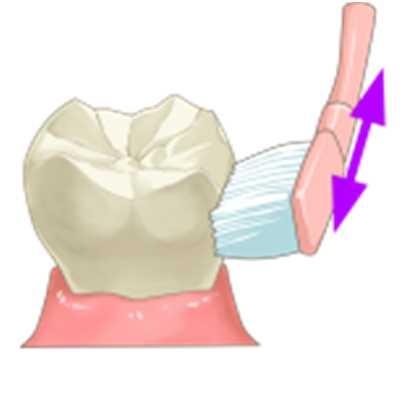 歯みがきを続けることができません ここでは できるだけ粘膜への刺激が少なく 痛くない歯みがき方法や刺激が少ないうがいの方法について説明します