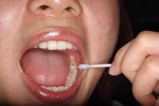 うるお口の中を潤す 保湿ケアをしましょう 抗がん剤の影響で唾液の分泌量が少なくなり 口が乾きやすくなります 潤いが不足していると 口の粘膜に傷がつきやすくなります